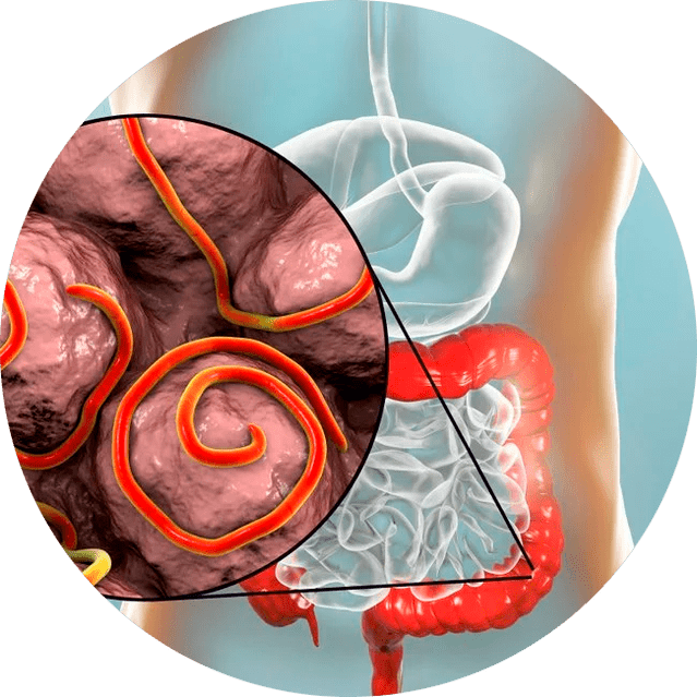 Tratto gastrointestinale e parassiti