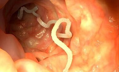 Cause dei parassiti nel corpo umano