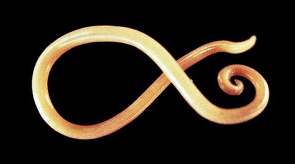 verme nematode dal corpo umano
