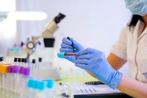 esame del sangue per i parassiti