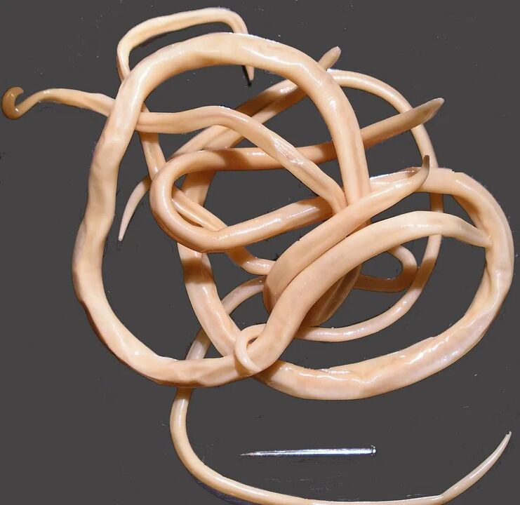 nematodi nel corpo umano